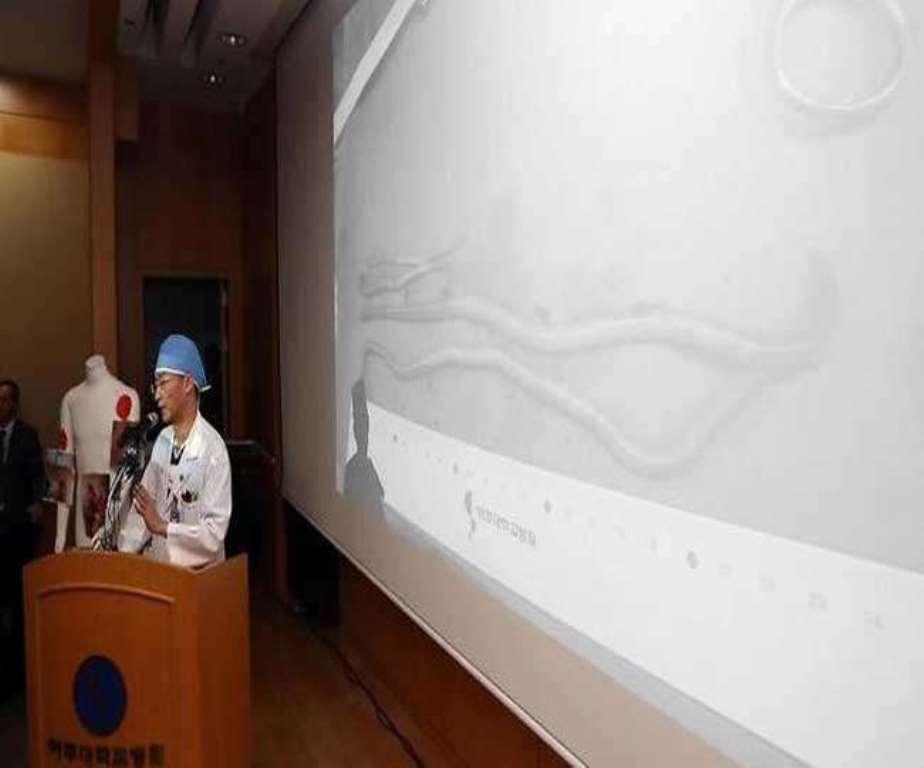 worm detected by Doctors Team